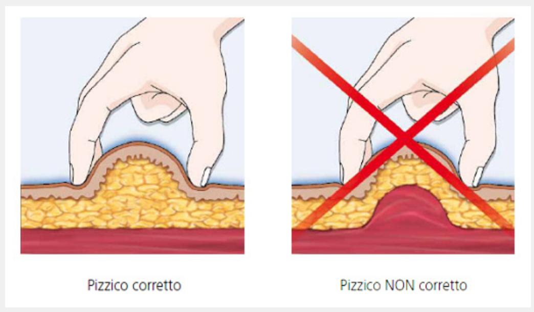 Infermieri Dalla Sede Di Iniezione Alla Rotazione Dei Siti Come